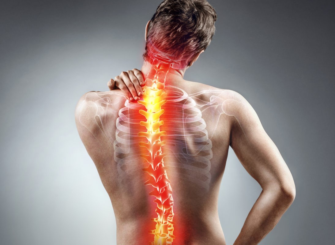 Օստեոխոնդրոզ остеохондроз osteoxondroz